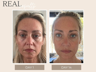 Real Results – Get inspired: A face lift in a tube?