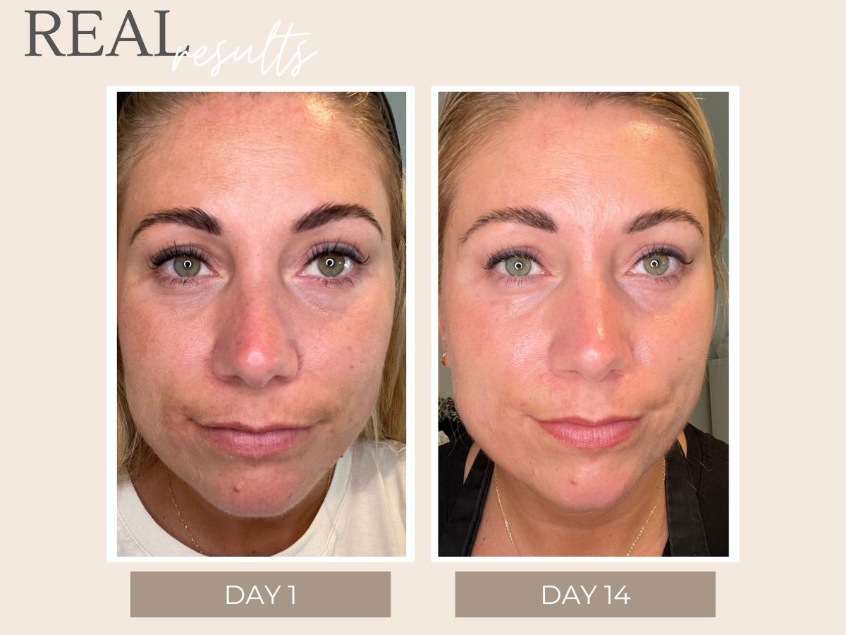 Real Results – Get inspired: Glow for it! – Katherine Daniels