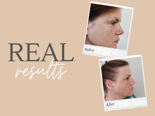 Real Results – Get Inspired: Sonja