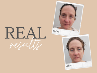 Real Results, Real People, Sensitive Skin