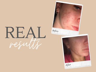 Real Results - Look at these results!