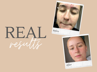 Real Results - WOW look at this transformation!