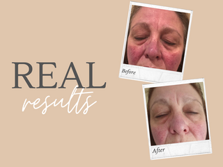 Real Results - Skincare that changes lives
