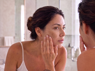 Hyperpigmentation: Why Stronger Skin Responds Better