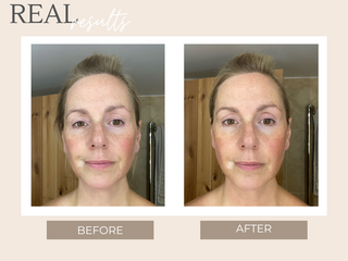 Real Results - 5 Star Mask
